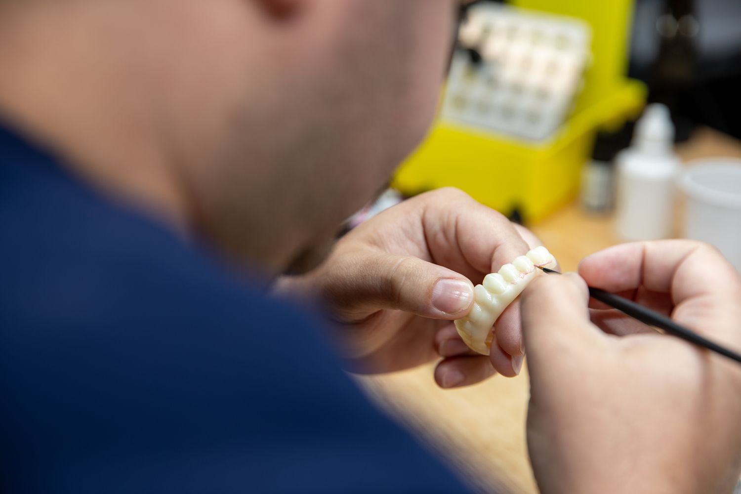 Lab tech crafting a full mouth implant