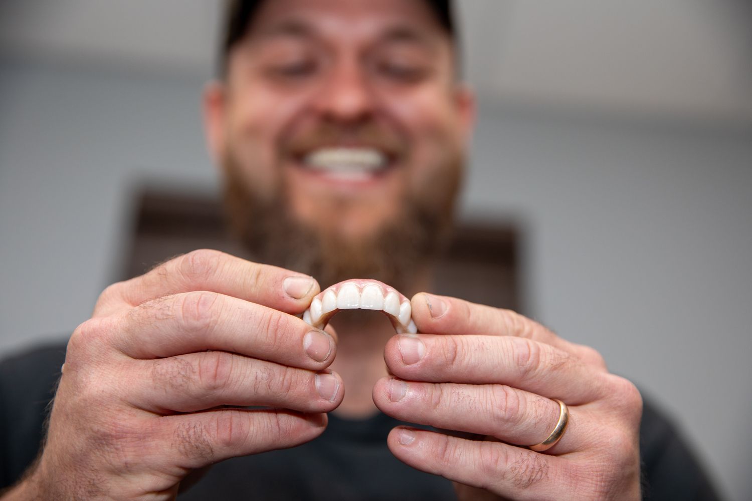 A patient with a full mouth implant prosthesis
